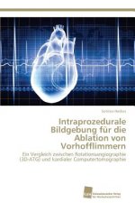 Intraprozedurale Bildgebung fur die Ablation von Vorhofflimmern