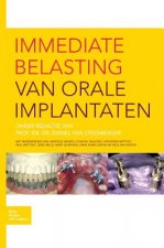 Immediate Belasting Van Orale Implantaten