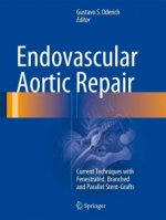 Endovascular Aortic Repair