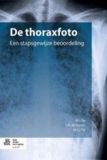 De thoraxfoto