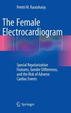 Female Electrocardiogram