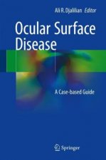 Ocular Surface Disease