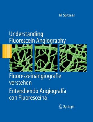 Understanding Fluorescein Angiography, Fluoreszeinangiografie verstehen, Entendiendo Angiografia con Fluoresceina