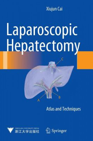 Laparoscopic Hepatectomy