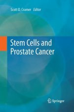 Stem Cells and Prostate Cancer