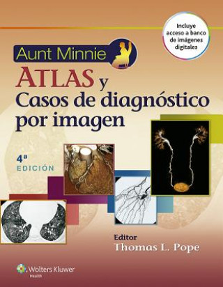Aunt Minnie. Atlas y casos de diagnostico por imagen