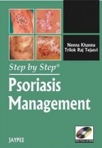 Step by Step: Psoriasis Management