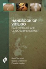 Handbook of Vitiligo