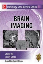 Radiology Case Review Series: Brain Imaging