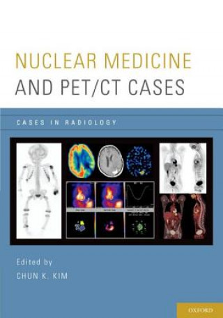 Nuclear Medicine and PET/CT Cases (Chun K. Kim)(Puha kötésű)