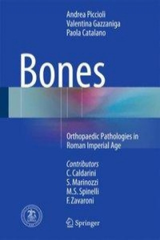 Bones