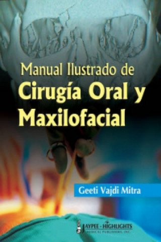 Manual Ilustrado de Cirugia Oral y Maxilofacial