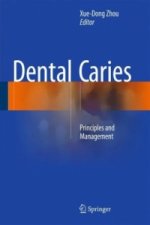 Dental Caries