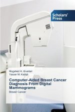 Computer-Aided Breast Cancer Diagnosis From Digital Mammograms