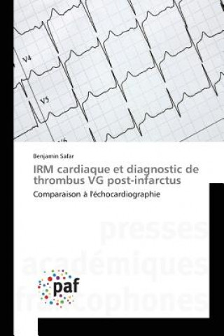 Irm Cardiaque Et Diagnostic de Thrombus Vg Post-Infarctus