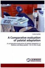 A Comparative evaluation of palatal adaptation