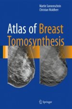 Atlas of Breast Tomosynthesis