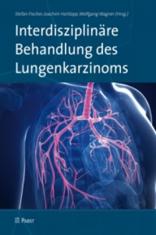 Interdisziplinäre Behandlung des Lungenkarzinoms