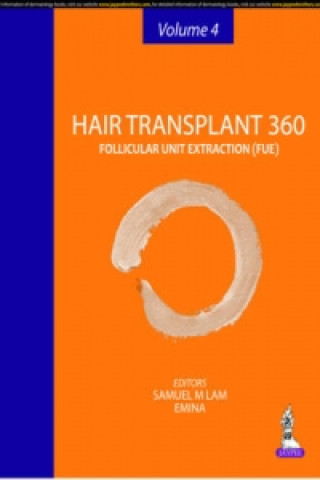 Hair Transplant 360