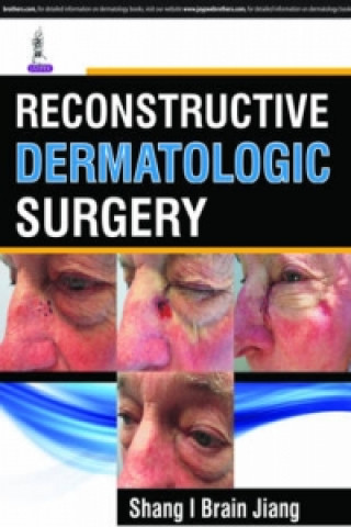 Reconstructive Dermatologic Surgery