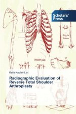 Radiographic Evaluation of Reverse Total Shoulder Arthroplasty
