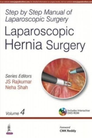 Step by Step Manual of Laparoscopic Surgery