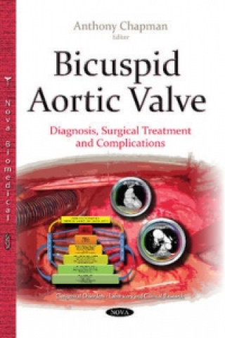 Bicuspid Aortic Valve