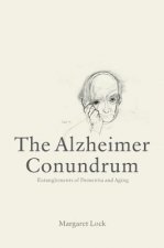 Alzheimer Conundrum