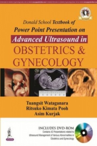 Donald School Textbook of Powerpoint Presentation on Advanced Ultrasound in Obstetrics & Gynecology