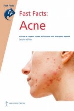 Fast Facts: Acne