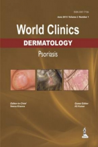 World Clinics: Dermatology: Psoriasis