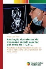 Avaliacao dos efeitos da expansao rapida maxilar por meio da T.C.F.C.