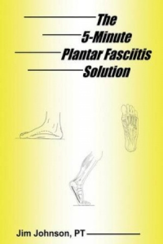 5-Minute Plantar Fasciitis Solution