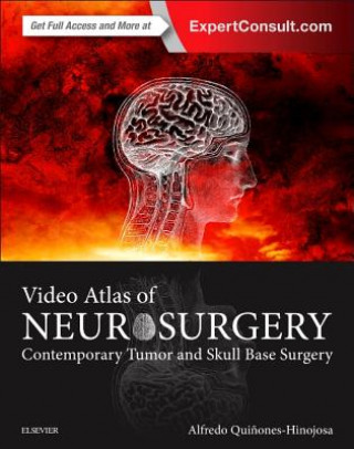 Video Atlas of Neurosurgery