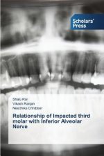Relationship of Impacted third molar with Inferior Alveolar Nerve