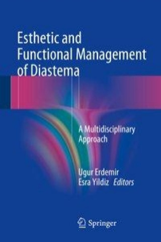 Esthetic and Functional Management of Diastema