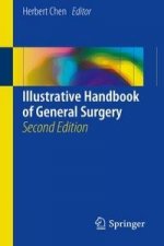 Illustrative Handbook of General Surgery