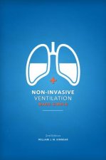 Non-Invasive Ventilation Made Simple