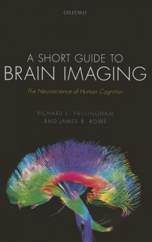 Short Guide to Brain Imaging
