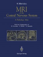 MRI of the Central Nervous System