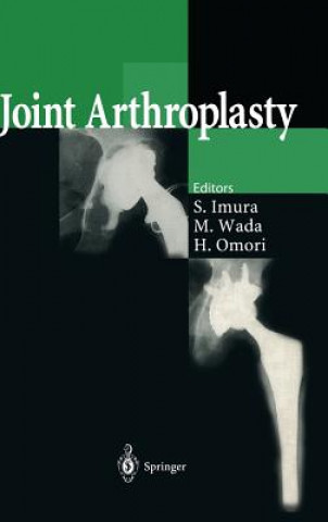 Joint Arthroplasty