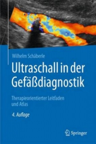 Ultraschall in der Gefadiagnostik