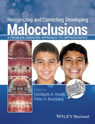 Recognizing and Correcting Developing Malocclusions - A Problem-Oriented Approach to Orthodontics
