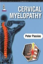 Cervical Myelopathy
