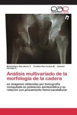 Analisis multivariado de la morfologia de la cadera