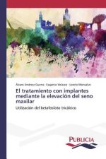 tratamiento con implantes mediante la elevacion del seno maxilar