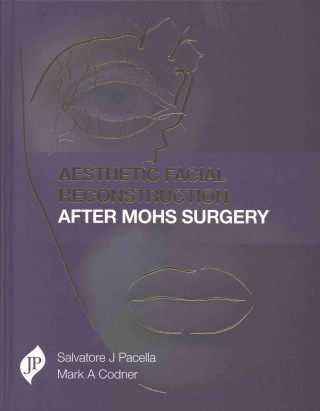 Aesthetic Facial Reconstruction After Mohs Surgery