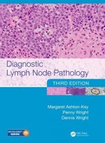 Diagnostic Lymph Node Pathology