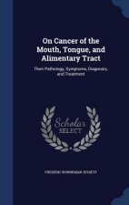 On Cancer of the Mouth, Tongue, and Alimentary Tract