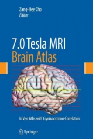 7.0 TeslaMRI Brain Atlas
